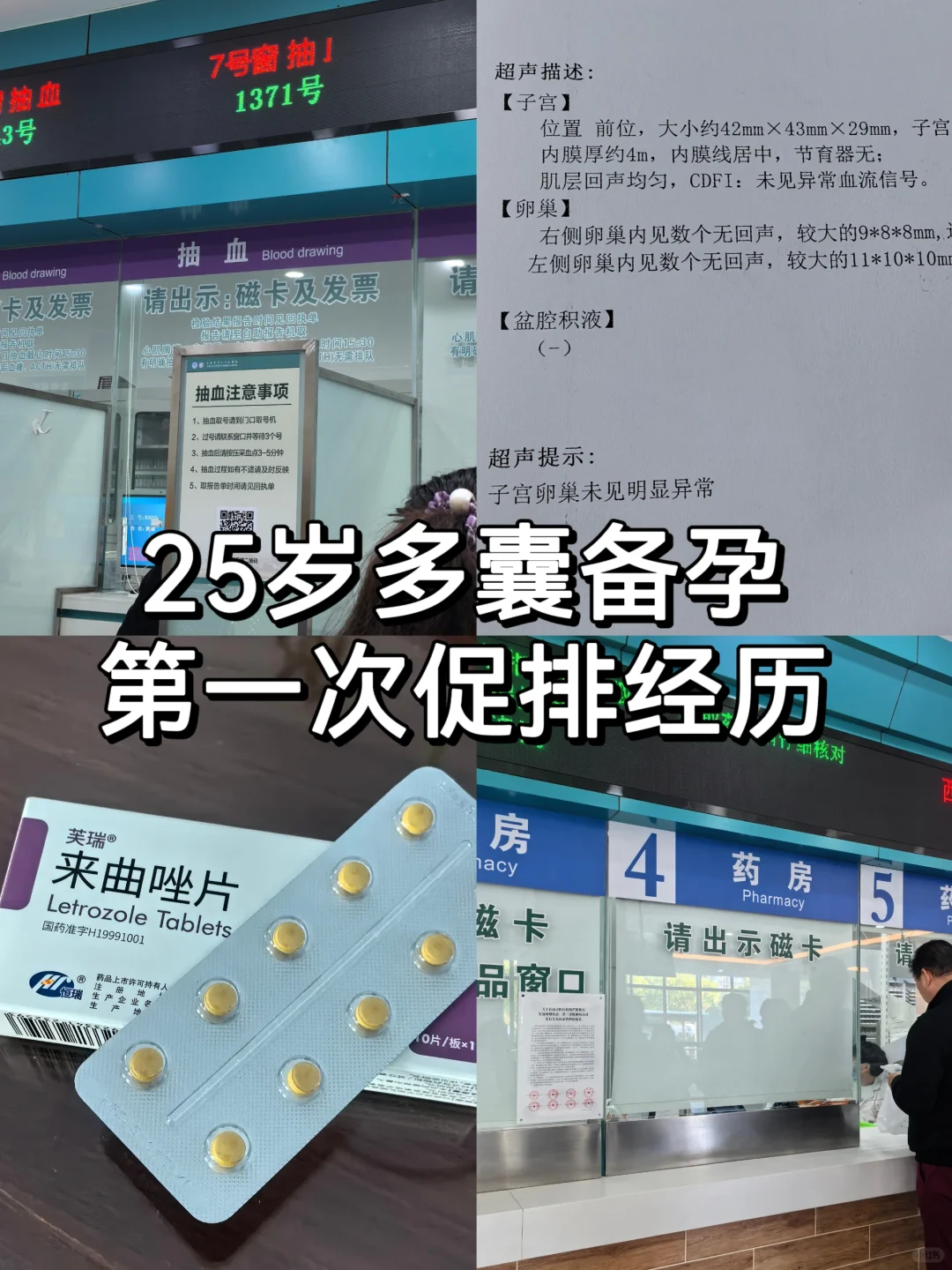 25岁多囊备孕：初次促排的宝贵经验
